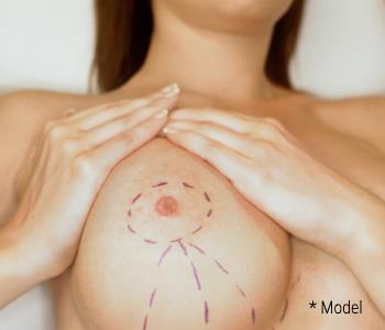 Best breast augmentation procedures from Dr. Dass in Beverly Hills CA