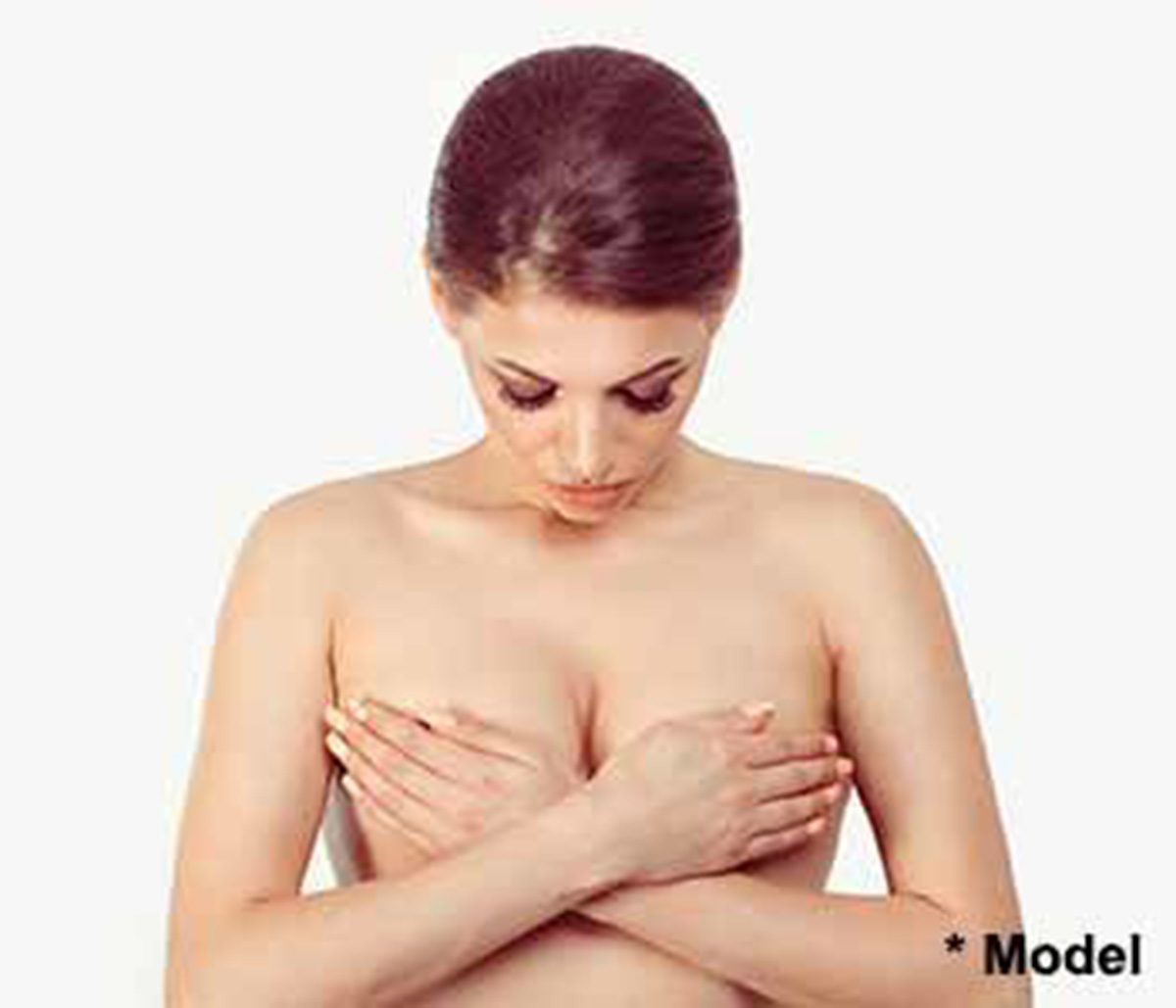 Breast augmentation involves the placement of breast implants to enhance and improve the shape and size of your breasts.