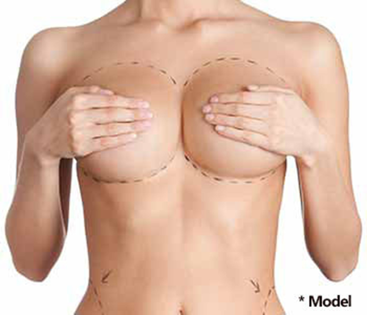 Beverly Hills specialist discusses long-term breast surgery