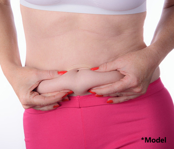 Can I get a Tummy Tuck after bariatric surgery?